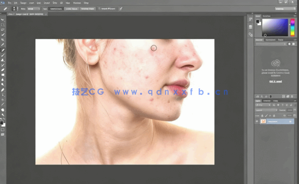 PS人像面部粉刺疤痕瑕疵美容去除处理视频教程(图5)
